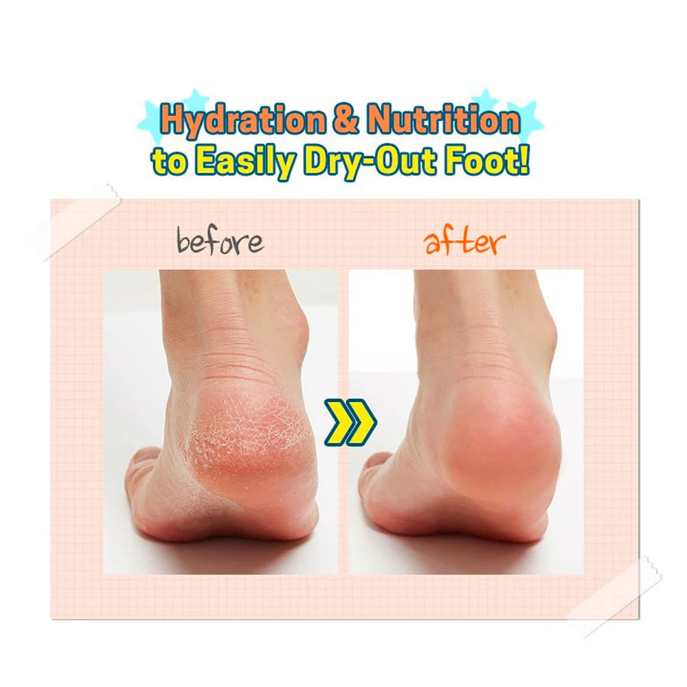 A'pieu Soft Foot 30 Minute Peeling Socks - TokTok Beauty