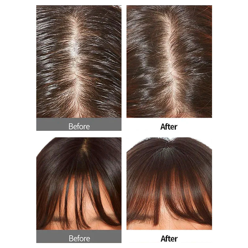 A'pieu Oily Hair Dry Powder - TokTok Beauty