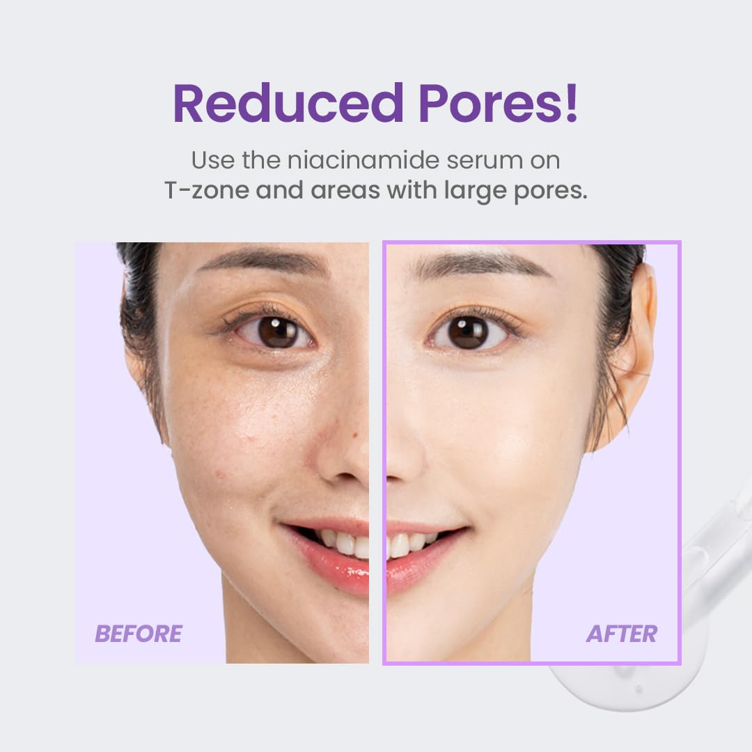 TIRTIR Niacinamide 20% Serum - TokTok Beauty