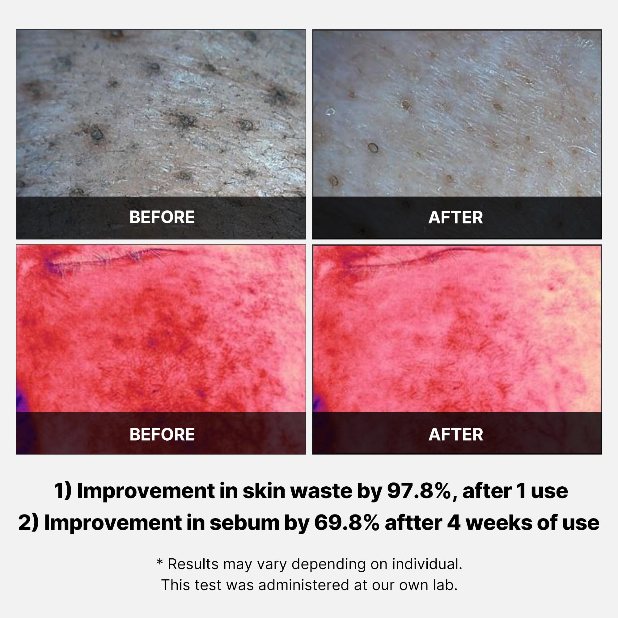 Red Succinic Acid Peeling Pad